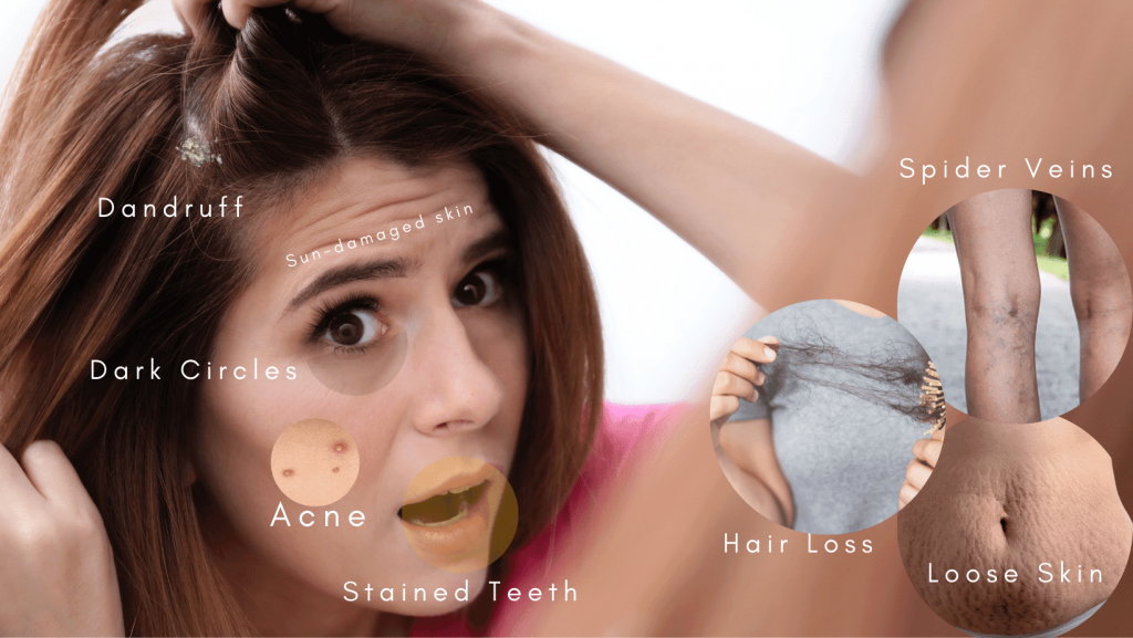 Beauty Problems Women Face And Tips To Treat Them