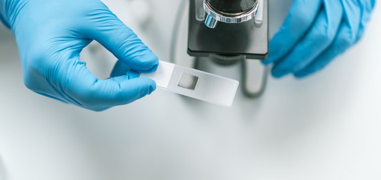 UnitedHealth’s Optum looks to cut down on unnecessary lab testing