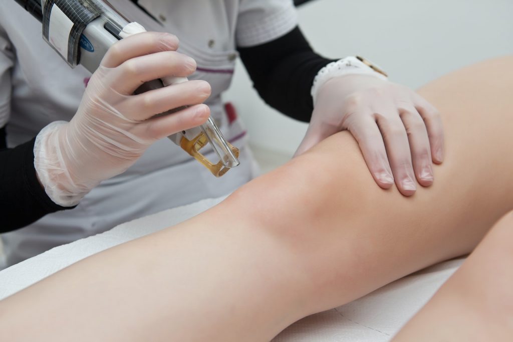 Top things to know before getting laser treatment – Beauty Conspirator