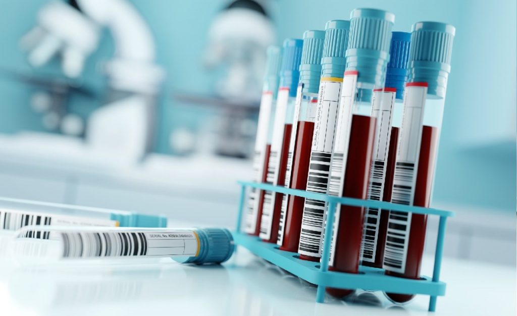 Blood tests for ‘forever chemicals’ should be offered to patients with high exposure: report