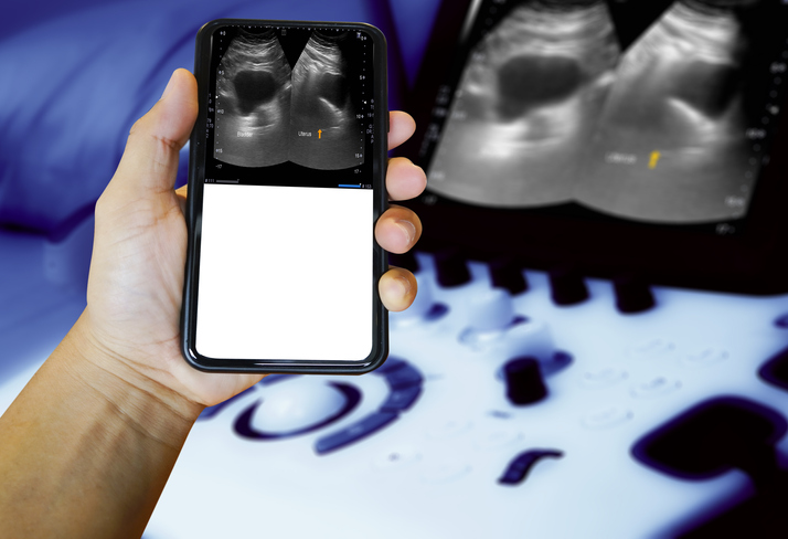 We’re in an era experiencing a tectonic shift in foundations of medical imaging – MedCity News