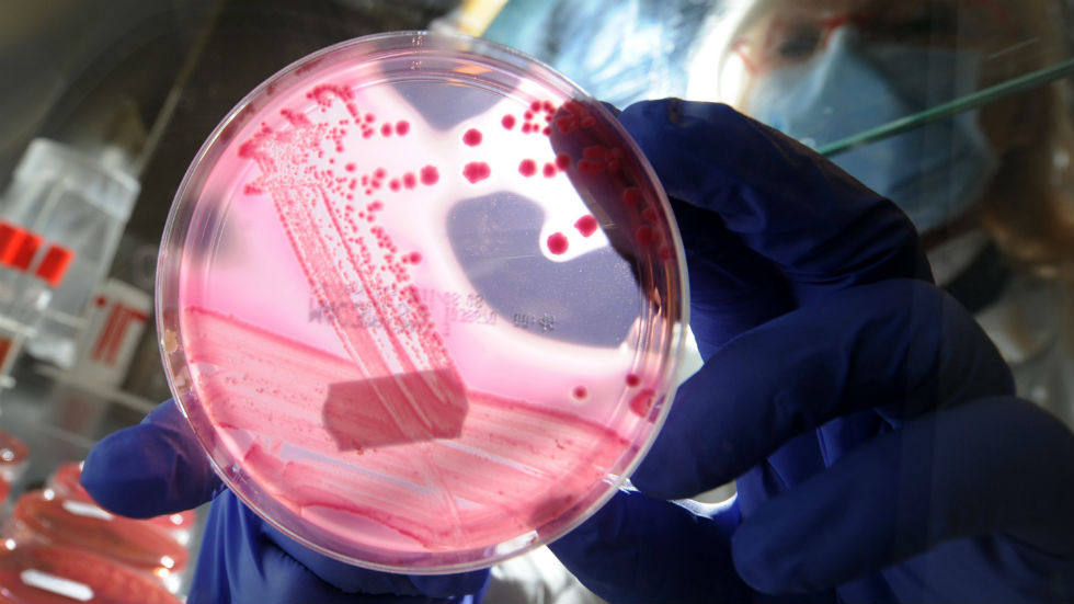 CDC investigating ‘fast-moving’ E. coli outbreak that has sickened dozens