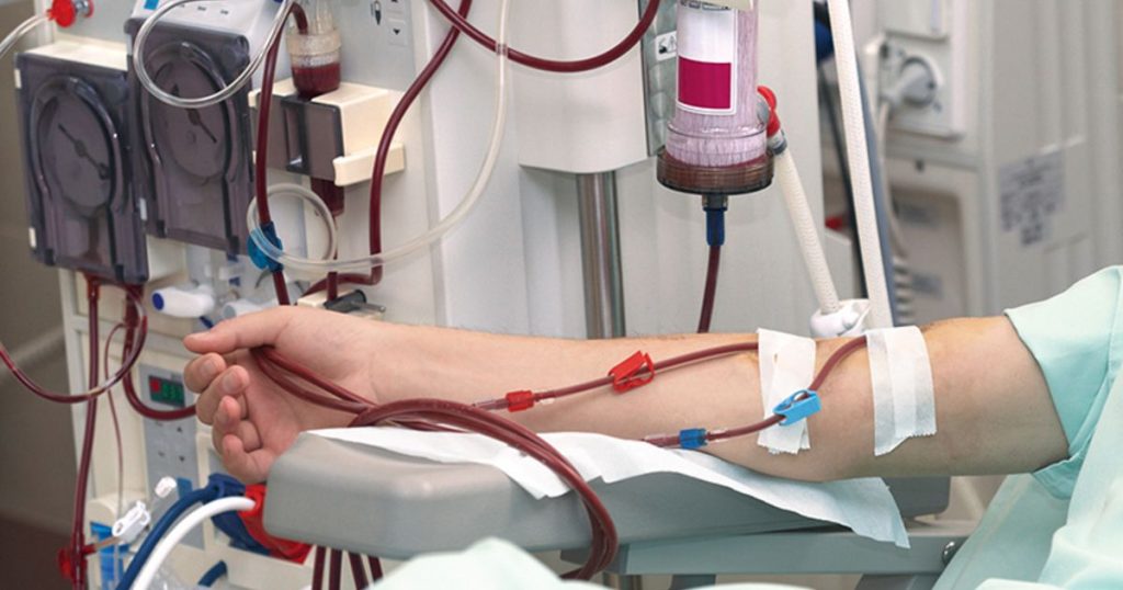 Dialysis consolidation bad for Medicare Advantage plan health, study says