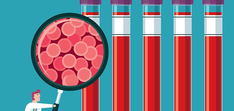 Ultrasensitive detection of MRD