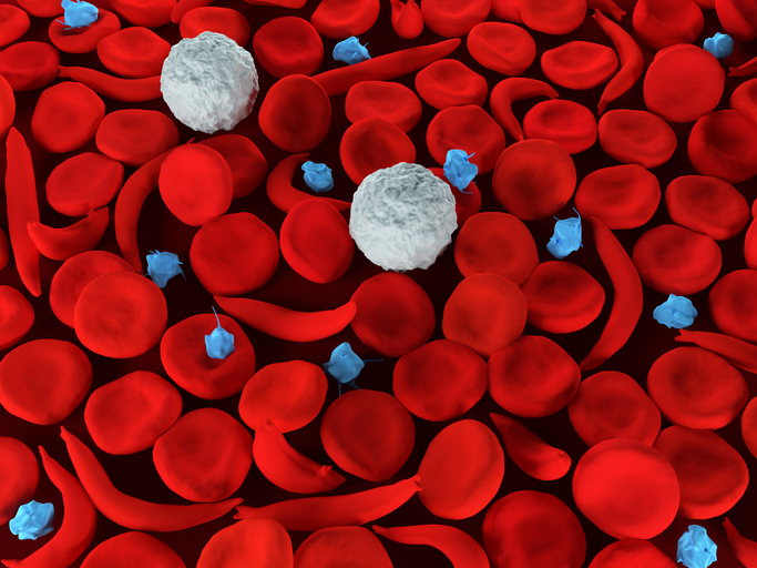 Novo Nordisk to buy sickle cell disease biotech Forma Therapeutics in $1.1B deal – MedCity News