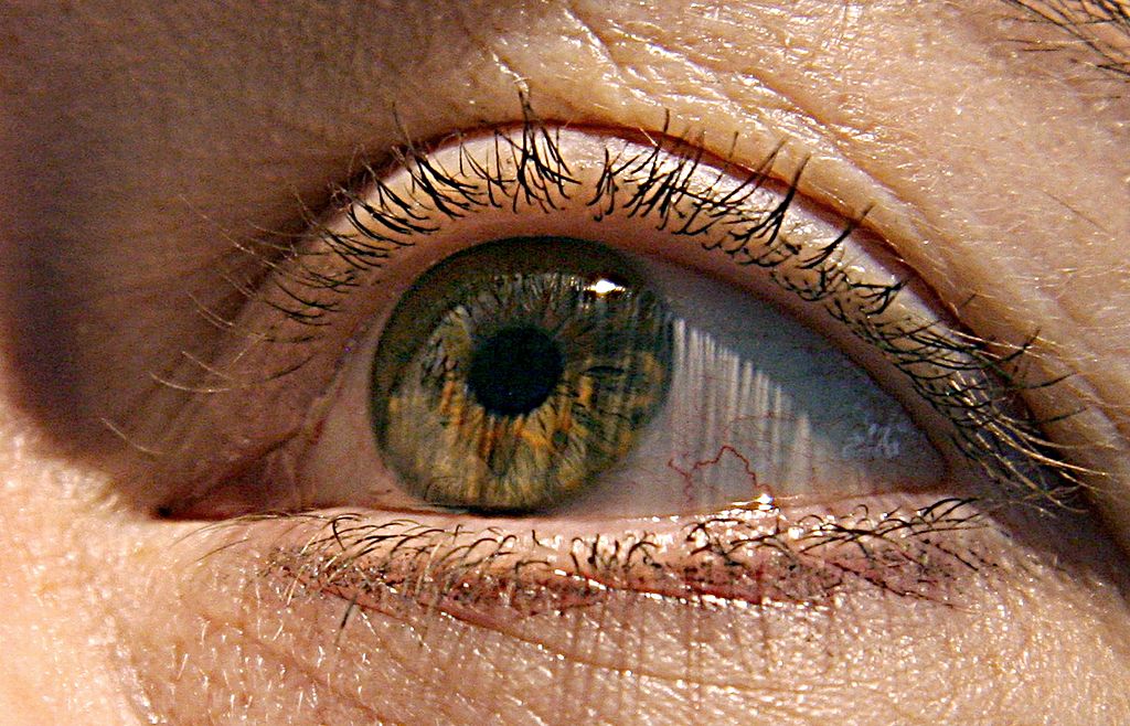 Eyenuk raises $26M for diabetic retinopathy screening tech – MedCity News