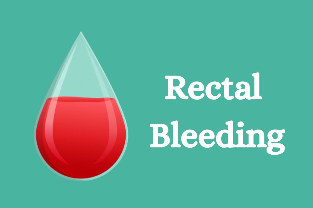 Rectal Bleeding-Symptoms,Causes and Treatment