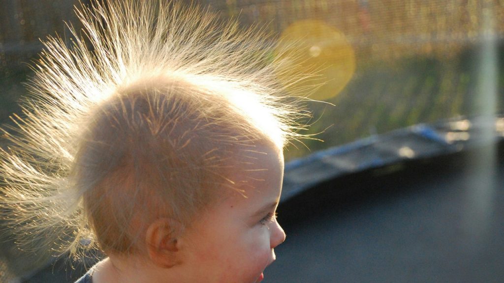 Uncombable Hair Syndrome Is a Real Thing — and This Little Girl Has It